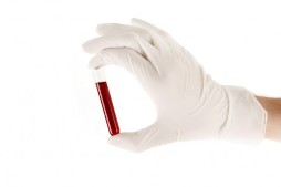 Анализ крови расшифровка cr